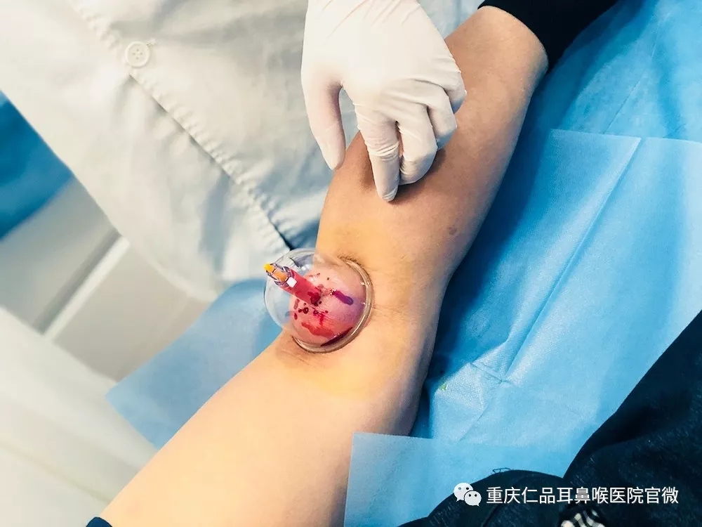 重庆仁品耳鼻喉医院