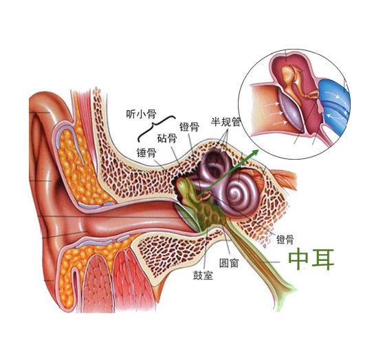 中耳炎