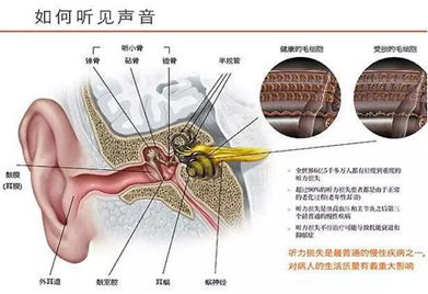 突发性耳聋的症状