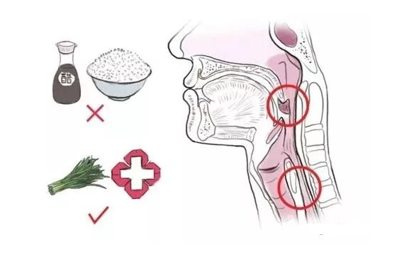 喉咙卡鱼刺