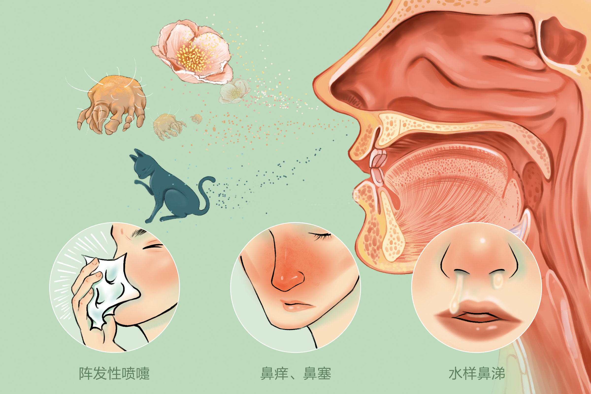 重庆过敏性鼻炎医院